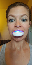 Load image into Gallery viewer, Truewhite Advanced LED Light Teeth Whitening System